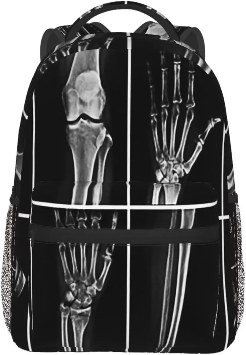 X Ray Skull Radiology Backpack for Men Women, Travel Laptop Backpack Computer Bag Daypack for Business Work Weekender