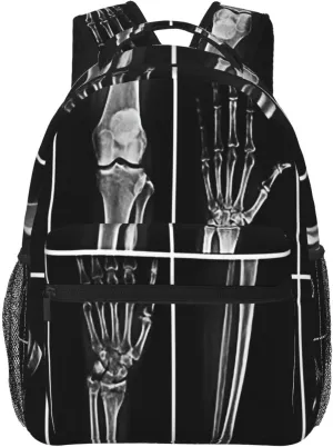 X Ray Skull Radiology Backpack for Men Women, Travel Laptop Backpack Computer Bag Daypack for Business Work Weekender