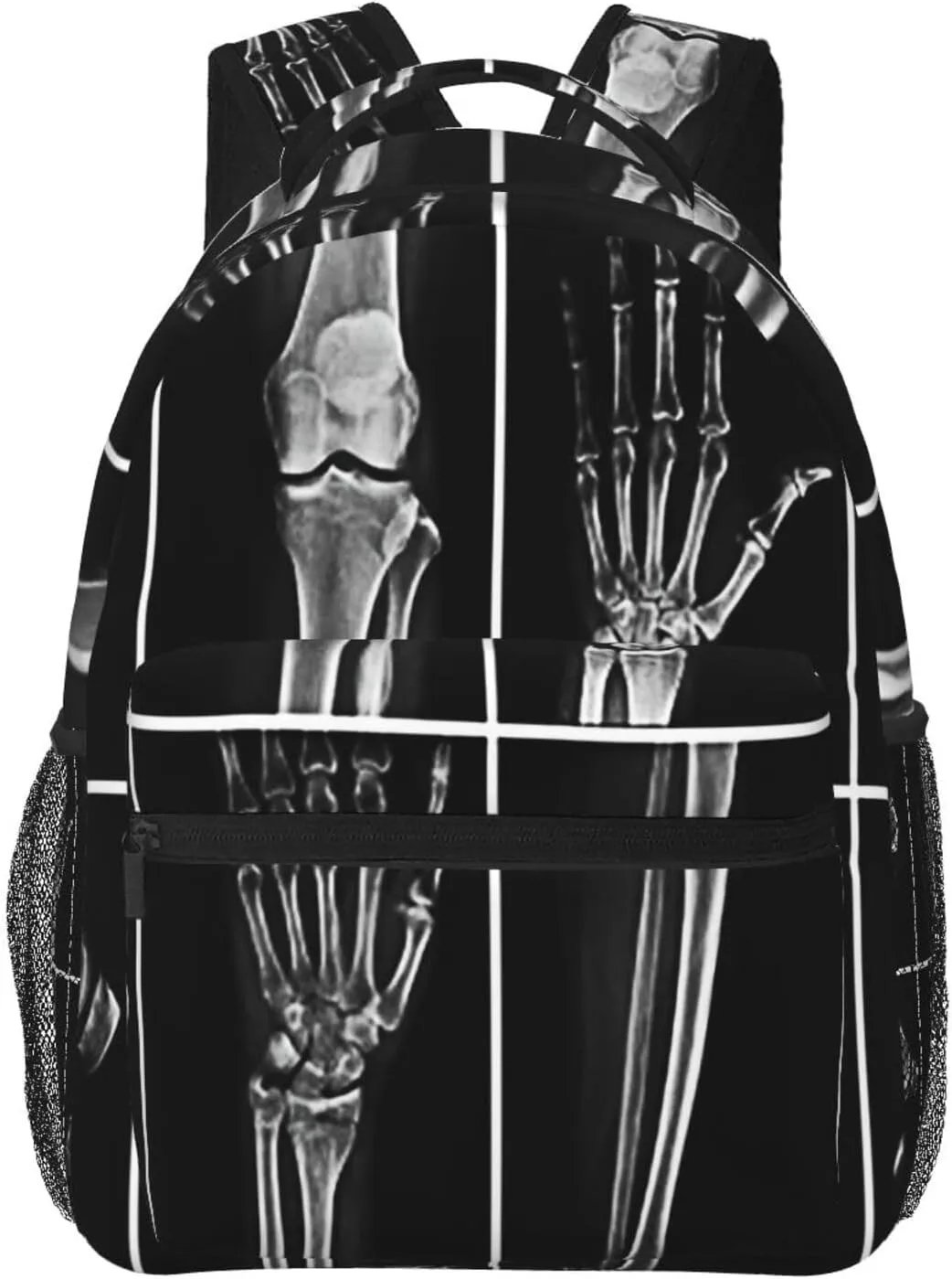 X Ray Skull Radiology Backpack for Men Women, Travel Laptop Backpack Computer Bag Daypack for Business Work Weekender